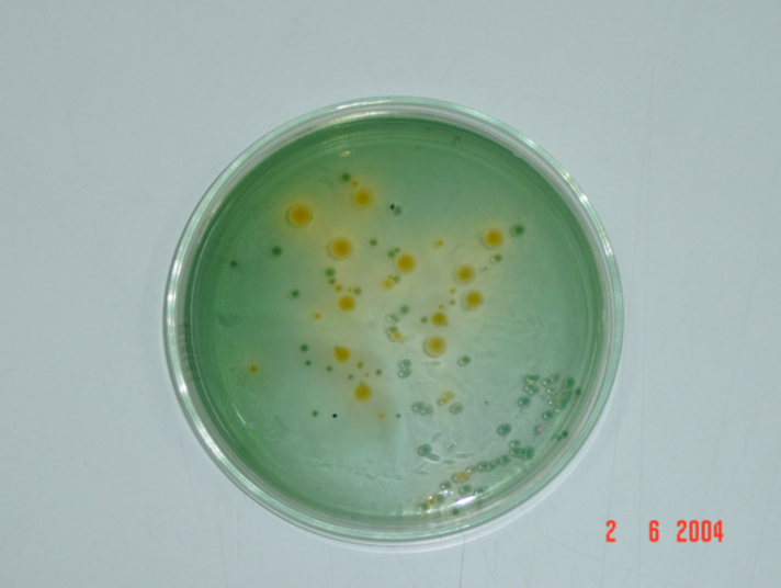 Đĩa thạch cấy vibrio trên mẫu phân trắng